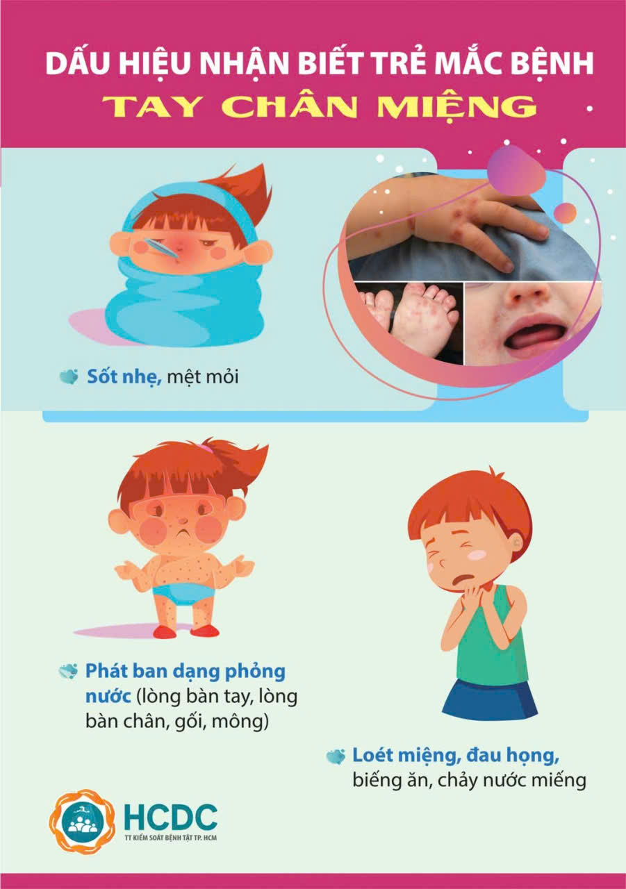 tay chân miệng trở nặng ggg